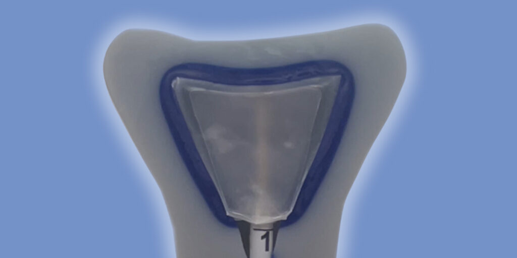 The Cerene cryotherapy endometrial ablation device